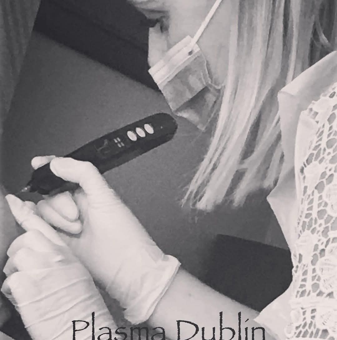 Plasma Pen skin tightening